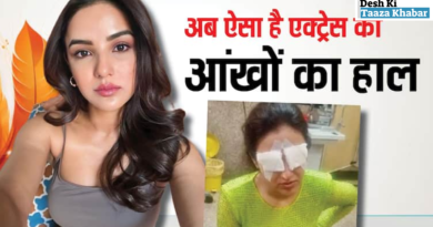 Jasmin Bhasin Shares Update on Her Eye Injury