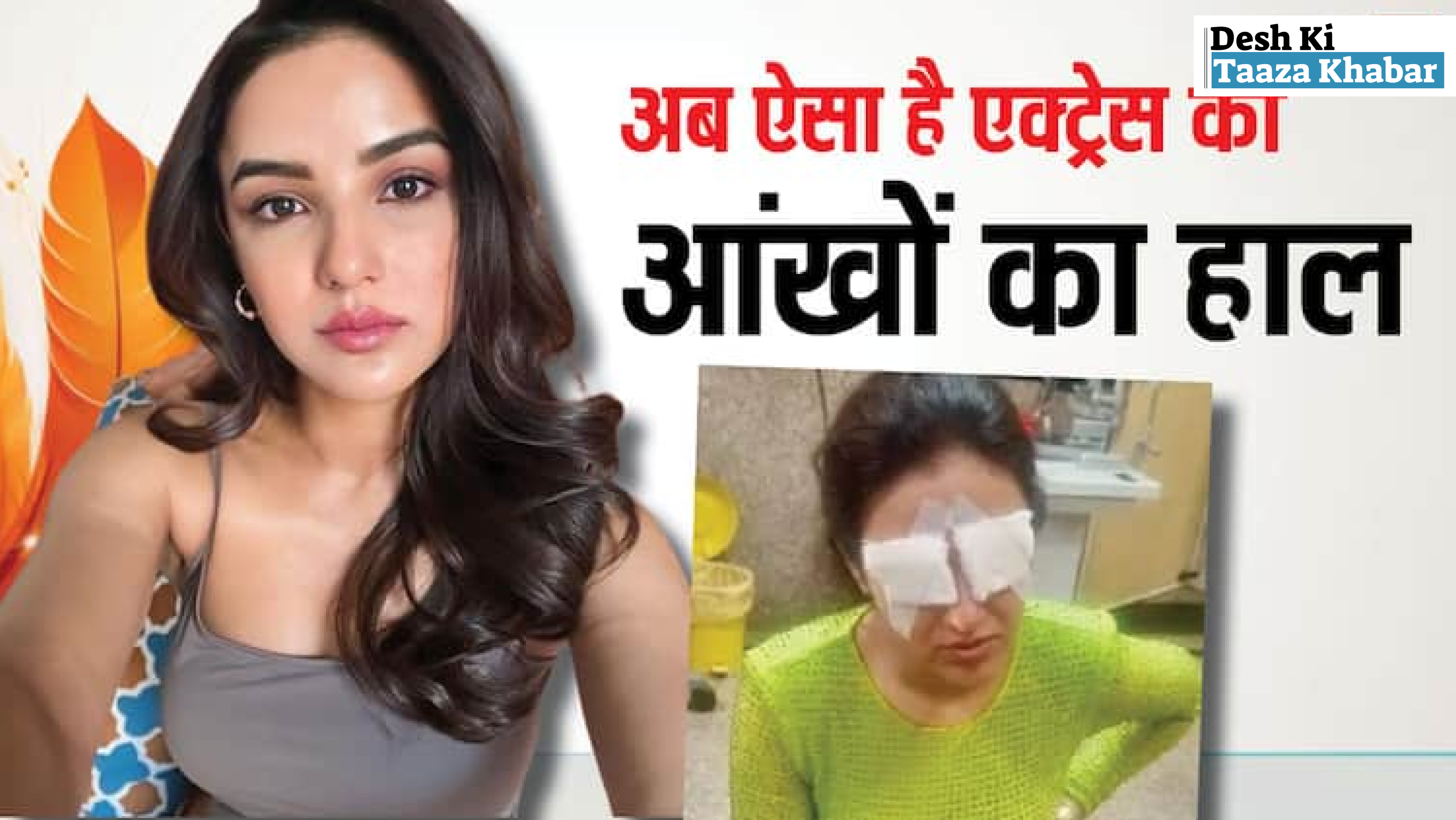 Jasmin Bhasin Shares Update on Her Eye Injury