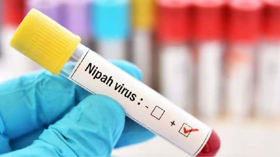 Nipah Virus: What You Need to Know About the Deadly Outbreak and How to Protect Yourself